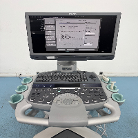 Acuson S1000 Mobile Ultrasound System image 2